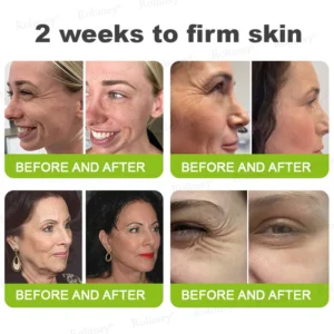 Rolimey® Botox & Vita-A Retinol Shot Wrinkle-Lift Tightening cream
