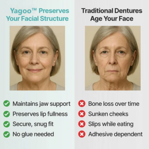 YAGOO™'s fully functional dentures