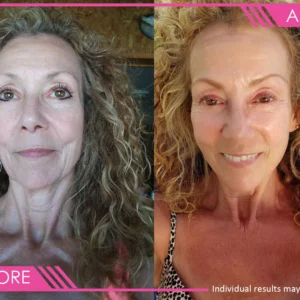 Vibriance™ Can Replace Every Face Cream In Your Cabinet