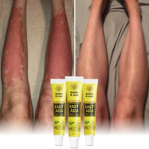 Smiles & Joys Treat Eczema And Psoriasis Naturally