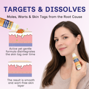 RZXEA™ Solid-Stick Wart Remover