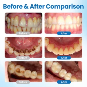 BBOJI NanoHAP Tooth Defense Serum