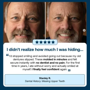 BQYOOMTM Custom-Fit Full Functional Dentures