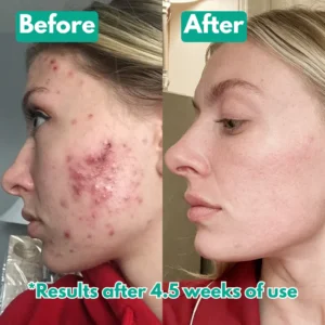 Lumera™ Microcrystal Serum PM