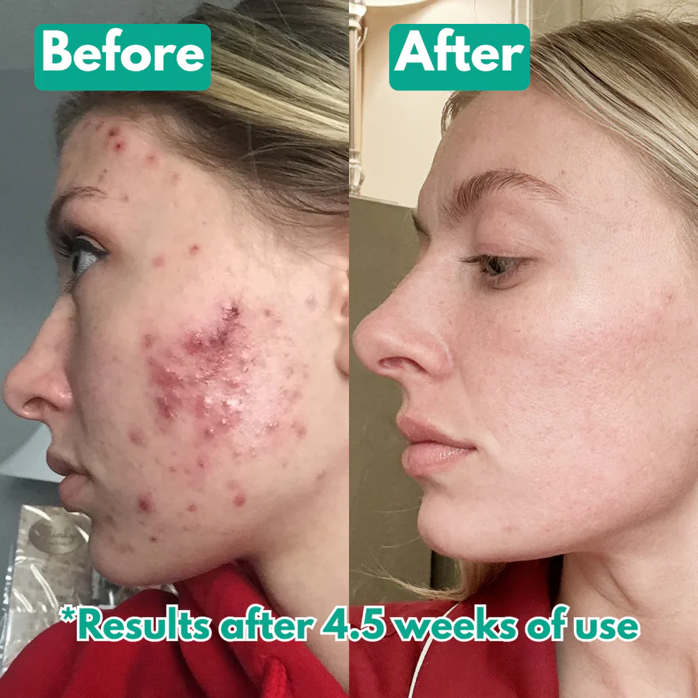 Lumera™ Microcrystal Serum PM