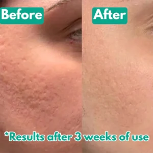 Lumera™ Microcrystal Serum PM