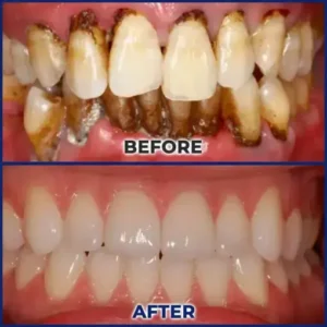 Croaie® ApiGuard BeeVenom Therapeutic Oral Drops and Rinse