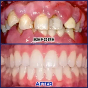 Croaie® ApiGuard BeeVenom Therapeutic Oral Drops and Rinse