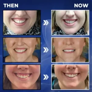 Croaie® ApiGuard BeeVenom Therapeutic Oral Drops and Rinse