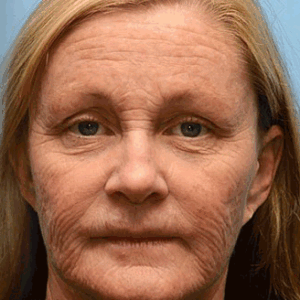 ODALIT™ Botox & Retinol Shot