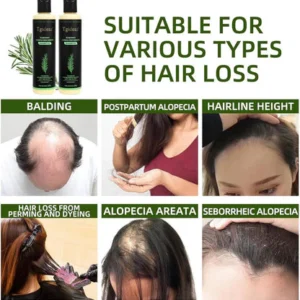 Tgideas Rosemary Shampoo