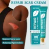 BQYOOM Scar Cream - Fade old scars, stretch marks & burns naturally