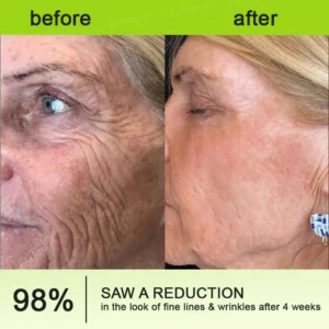 QIAWI™ Botulinum & Vita-A Retinol Shot Wrinkle-Lift Tightening cream