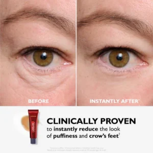 LOVILDS™ Eye Bag Instant Eraser