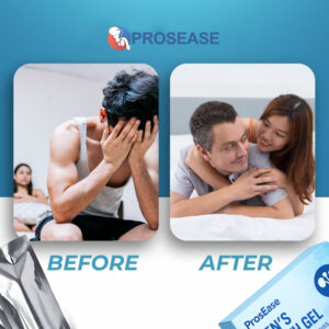 ProsEase - Gel | Improved performance and stronger erections in just one application