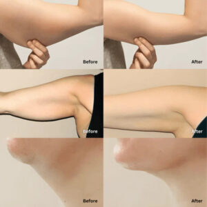 Fosters Organic Lymphatic Support Herbal Blend