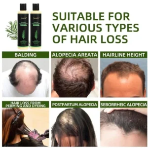 Juxek® Organic Rosemary Hair Growth Shampoo