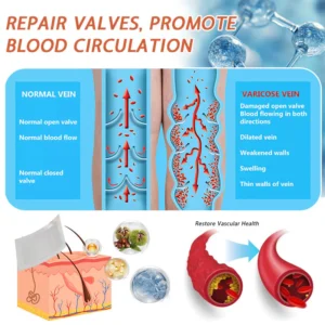 Zvoevo® Vein Ease Microneedle Care Patch