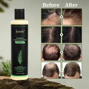 Juxek® Organic Rosemary Hair Growth Shampoo