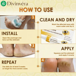 Divinvéra BEE VENOM WART CORN & CALLUS REMOVER CREAM