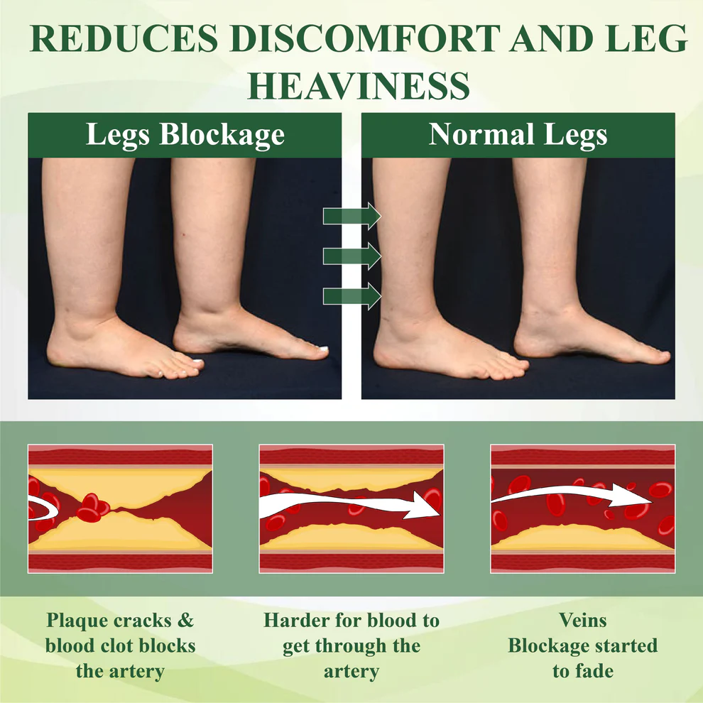 ATTDX® FluidEase Leg Therapy Edema Cream