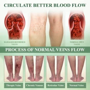 ATTDX® FluidEase Leg Therapy Edema Cream