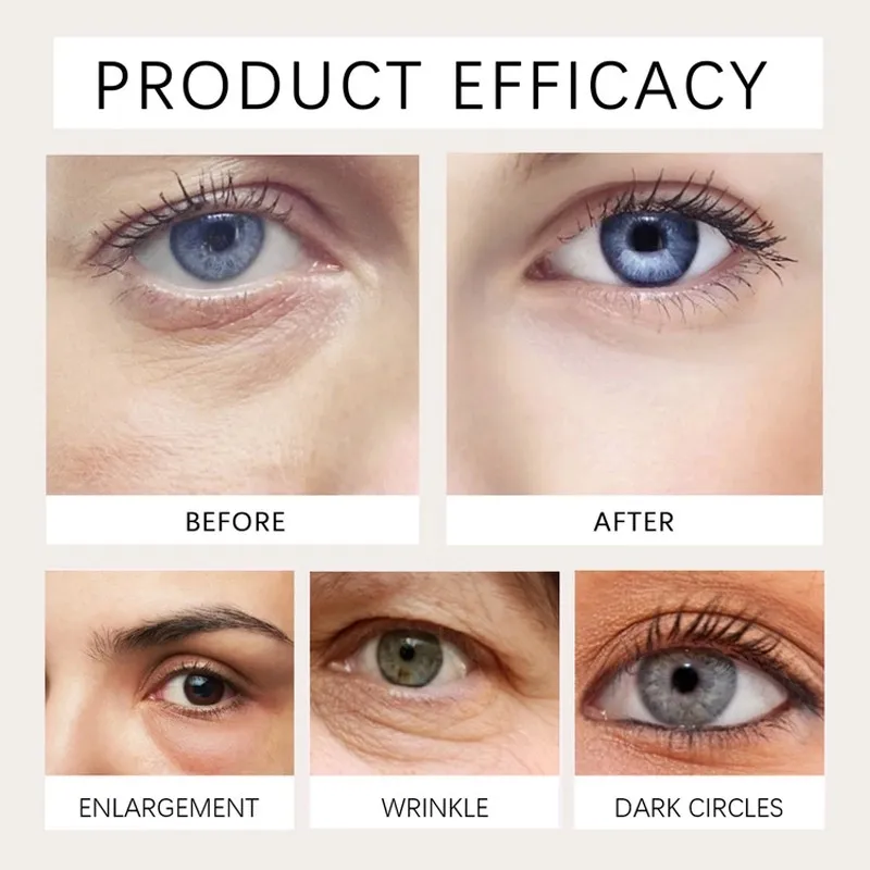 Elycura™ Castor Oil Under Eye Roll On