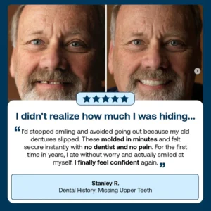 SEAGRIL™ Custom-Fit Full Functional Dentures