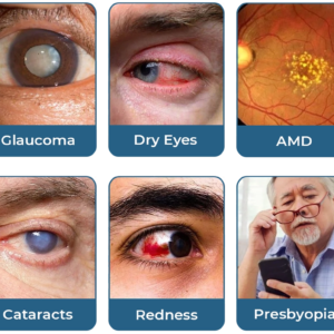 Eye Revive Power of Herbs For Your Eyes