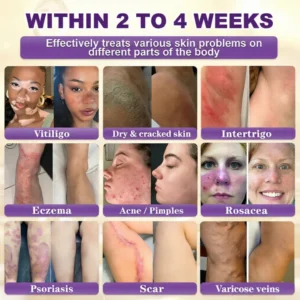 SEAGRIL® Biotin 10-in-1 Skin Restoration Cream