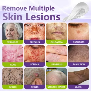 GFOUK® Soluble Microneedle Botanical Skin Tag Removal Patch