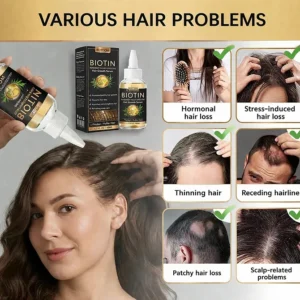 BQYOOM® Highly Effective Biotin & Rosemary Hair Growth Serum