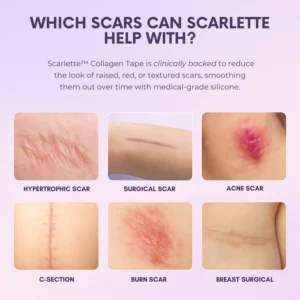 Scarlette™ Silicone Collagen Sheets