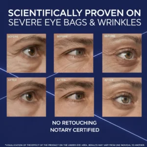 BARUBT Eye Skincare Under-Eye Bag Cream