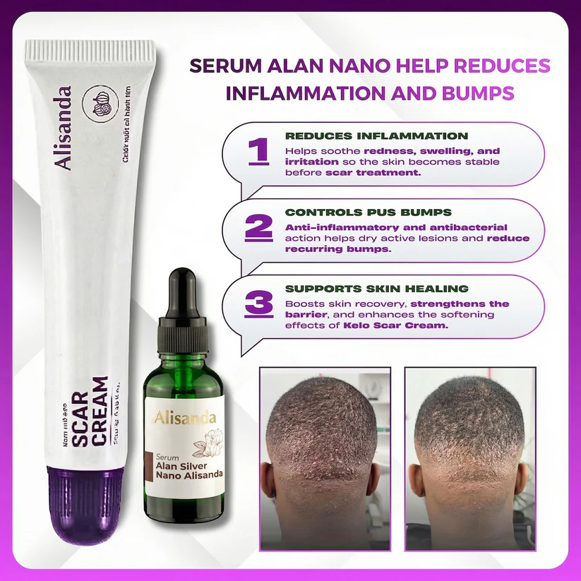 Alisanda Scar Cream