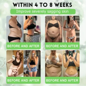 Amzkeep NAD+ Moringa Berberine AMPK Support Patch