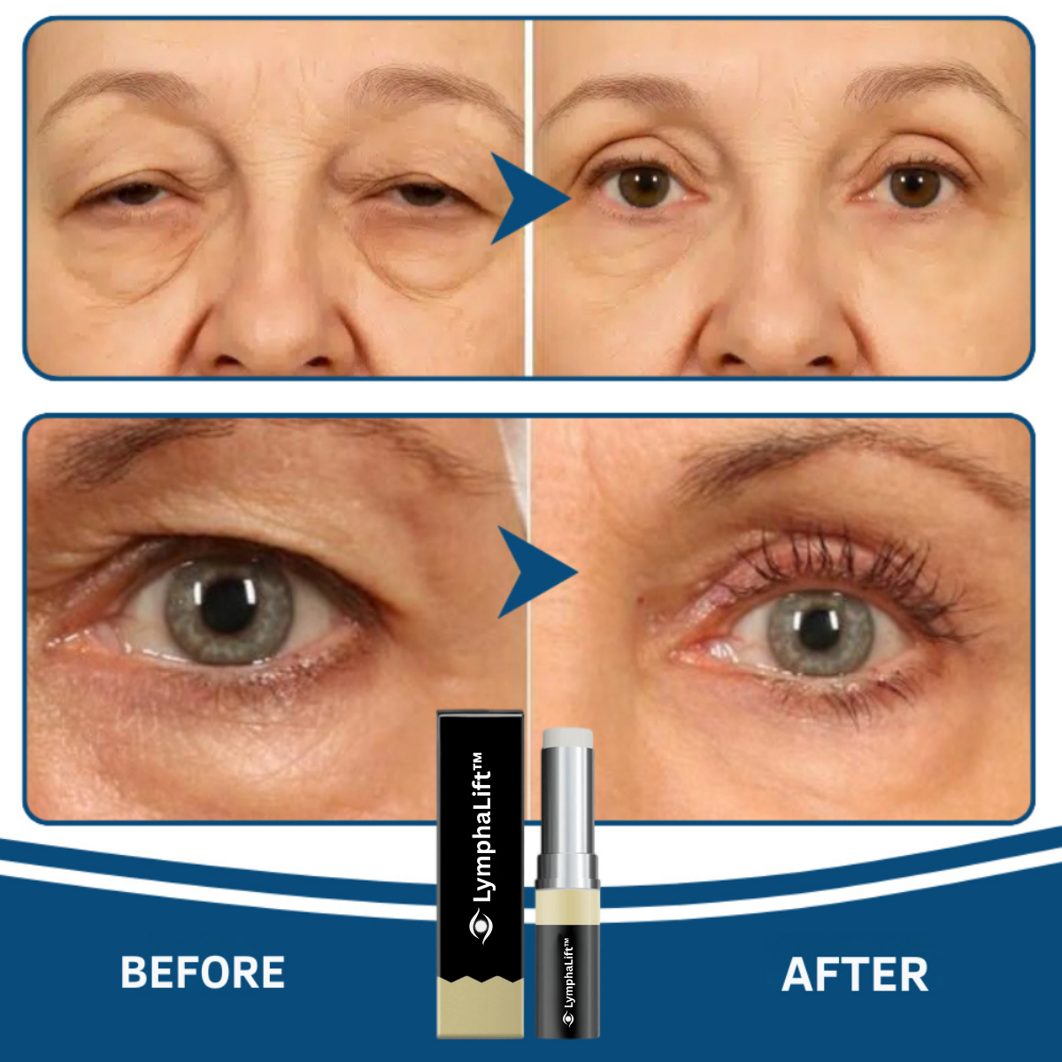 LymphaLift Balm Stick