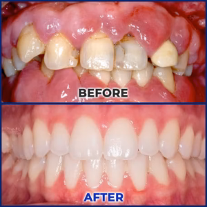 BQYOOM® BeeTakt Oral Repair Solution