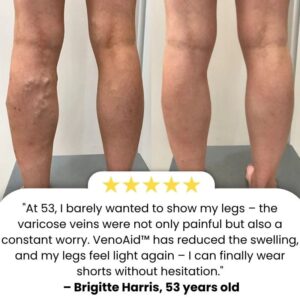 BioEquis Vein Relief Spray