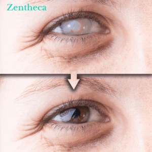 Relieflogix Vision Care Roller