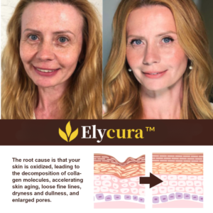 Elycura Retinol Cream Anti-Aging