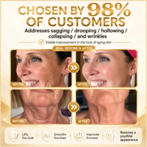 Devioa® Bee Poison Skin Restoration Cream