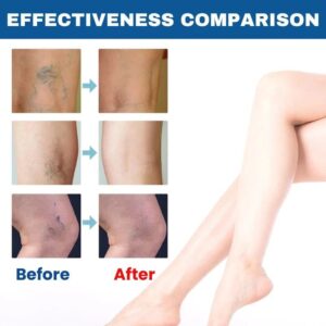 BioEquis Vein Relief Spray