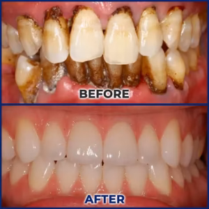 BQYOOM® BeeTakt Oral Repair Solution