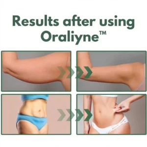 Oraliyne™ Firms and lifts sagging skin